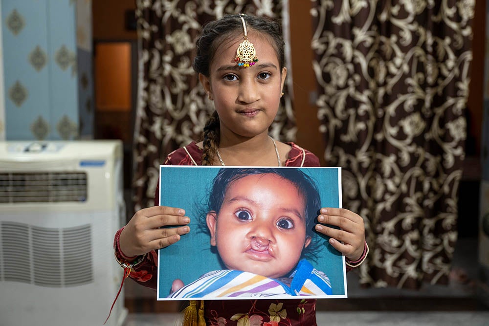 Bhumika souriante et tenant une photo d'elle avant sa chirurgie de la fente