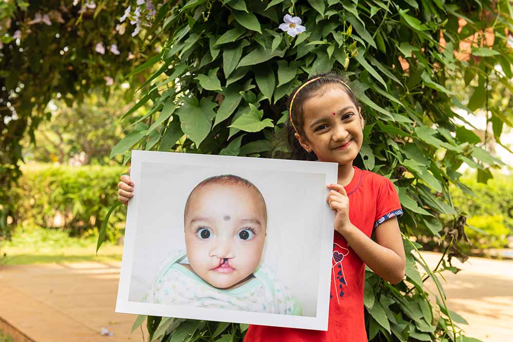 Durva smiles and holds up a baby photo of herself from before cleft care