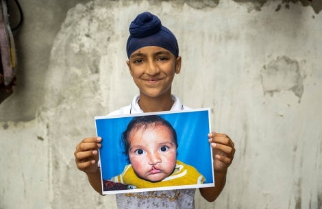Anmolpreet souriant et tenant une photo de lui lorsqu’il était bébé avant la chirurgie pour le traitement de sa fente